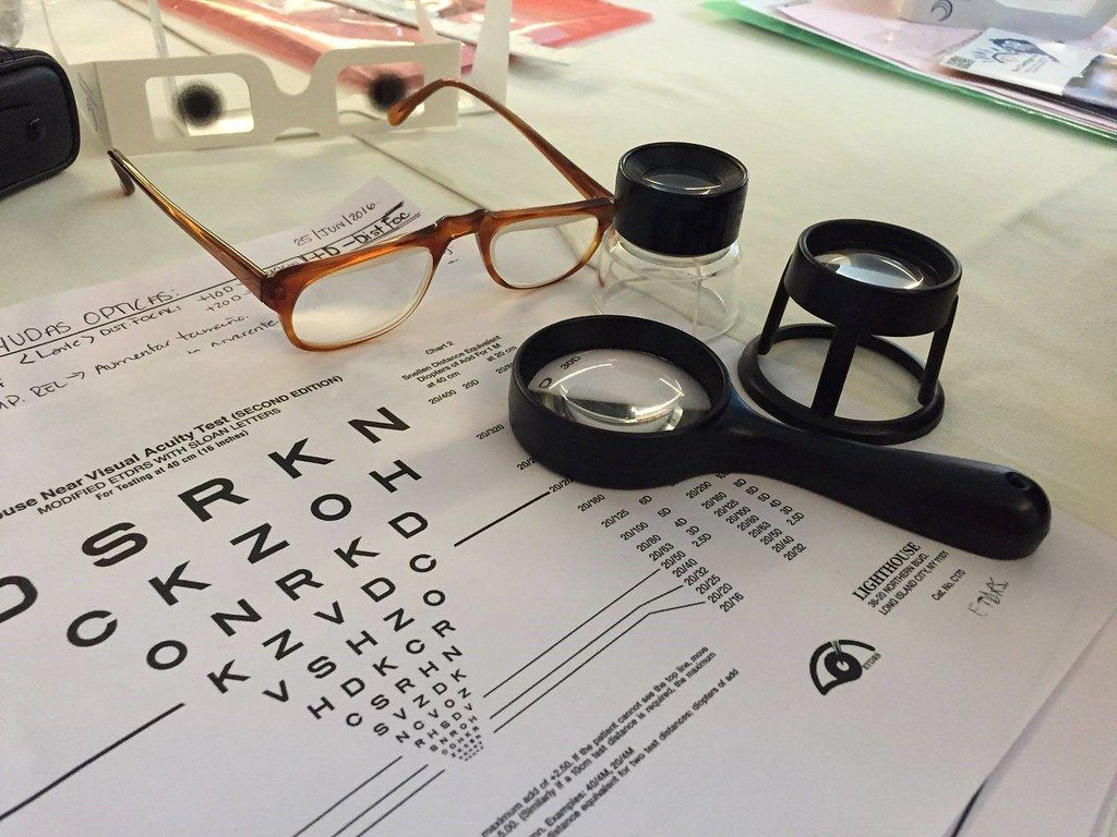 revision ocular