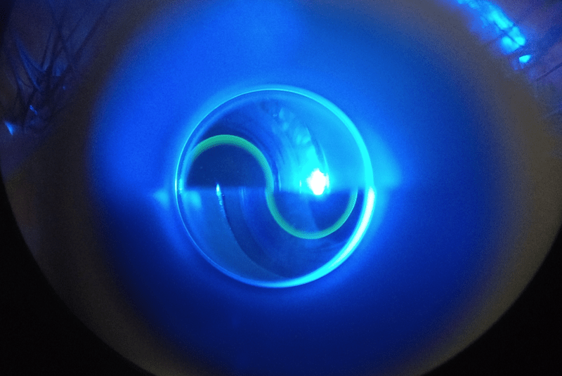 revision ocular